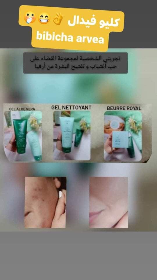 Gel d'Aloe vera