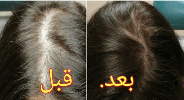 مواد أخرى