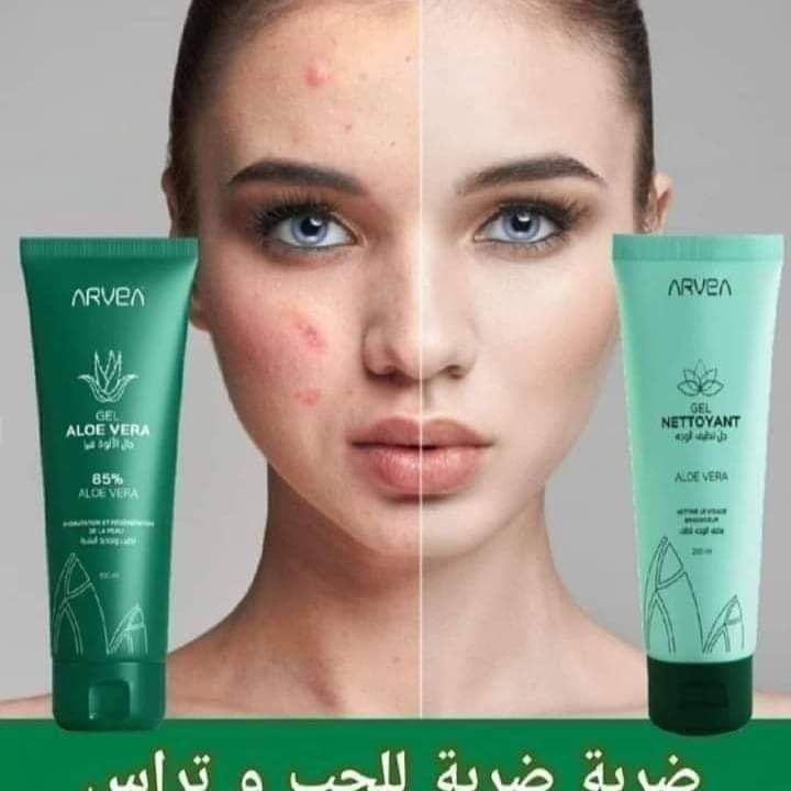 منتج لعلاج حب الشباب 